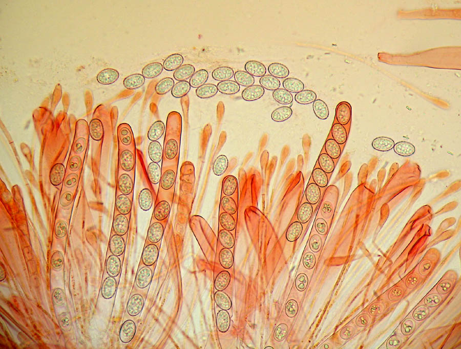 Scutellinia sp